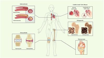 AnnexinA6: a potential therapeutic target gene for extracellular matrix mineralization